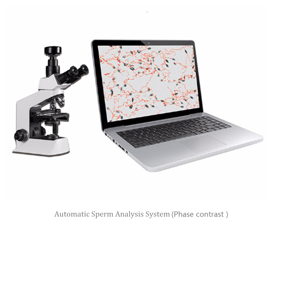 computer assisted semen analysis Automated Sperm Analyzer