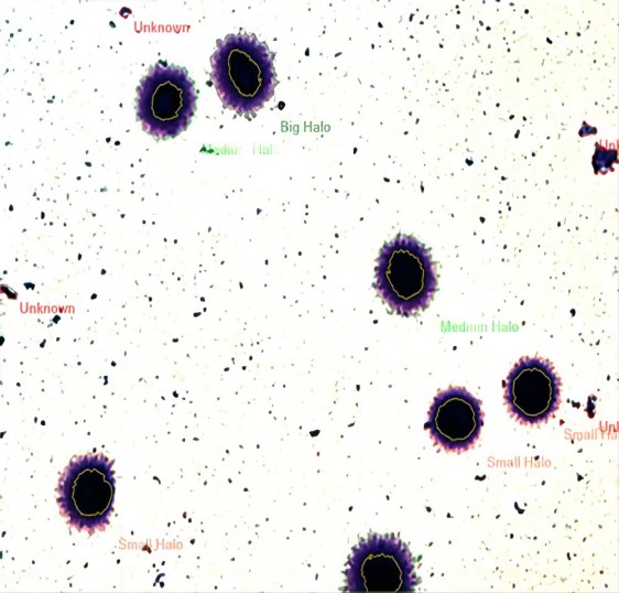 Computer-Assisted-Semen-Analysis-Sperm-DNA-Fragmentation